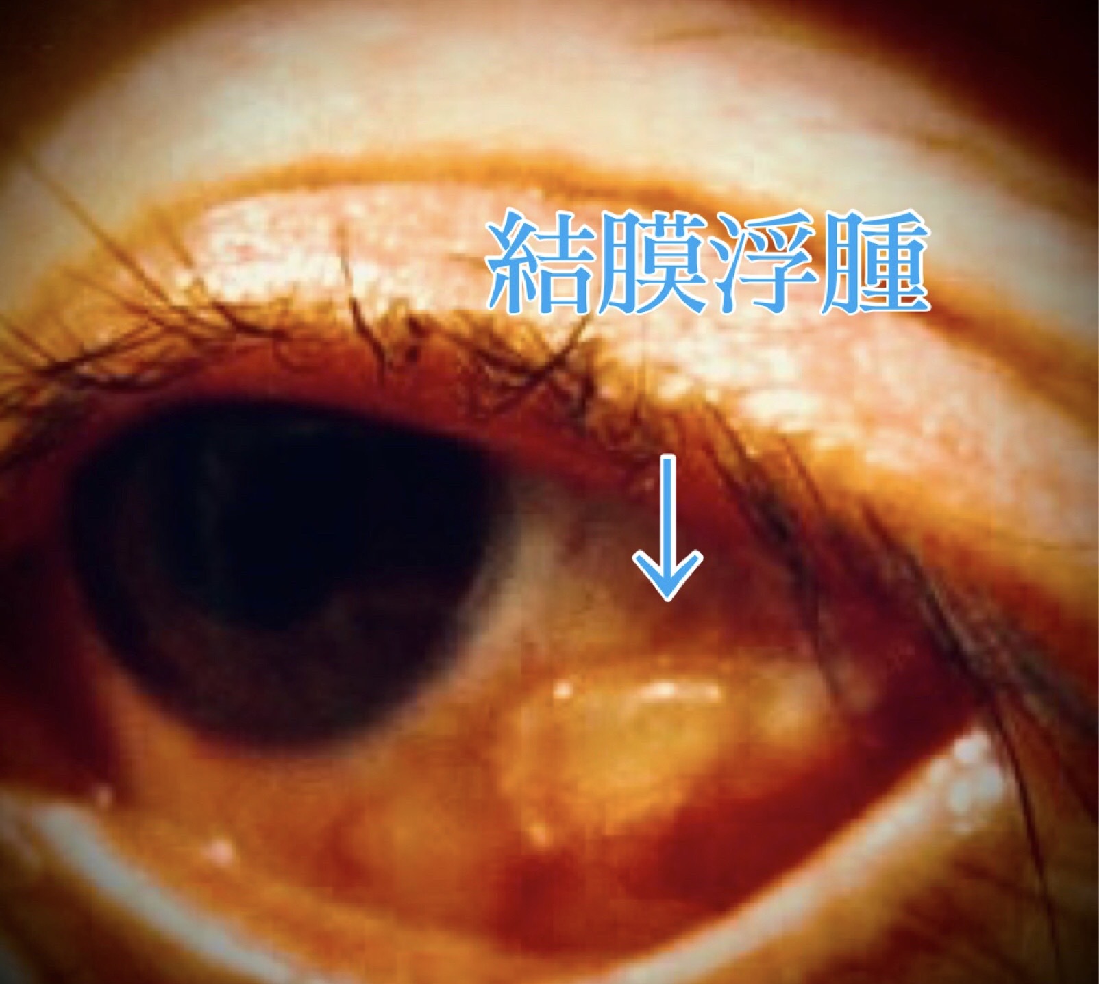 目が大変なことに